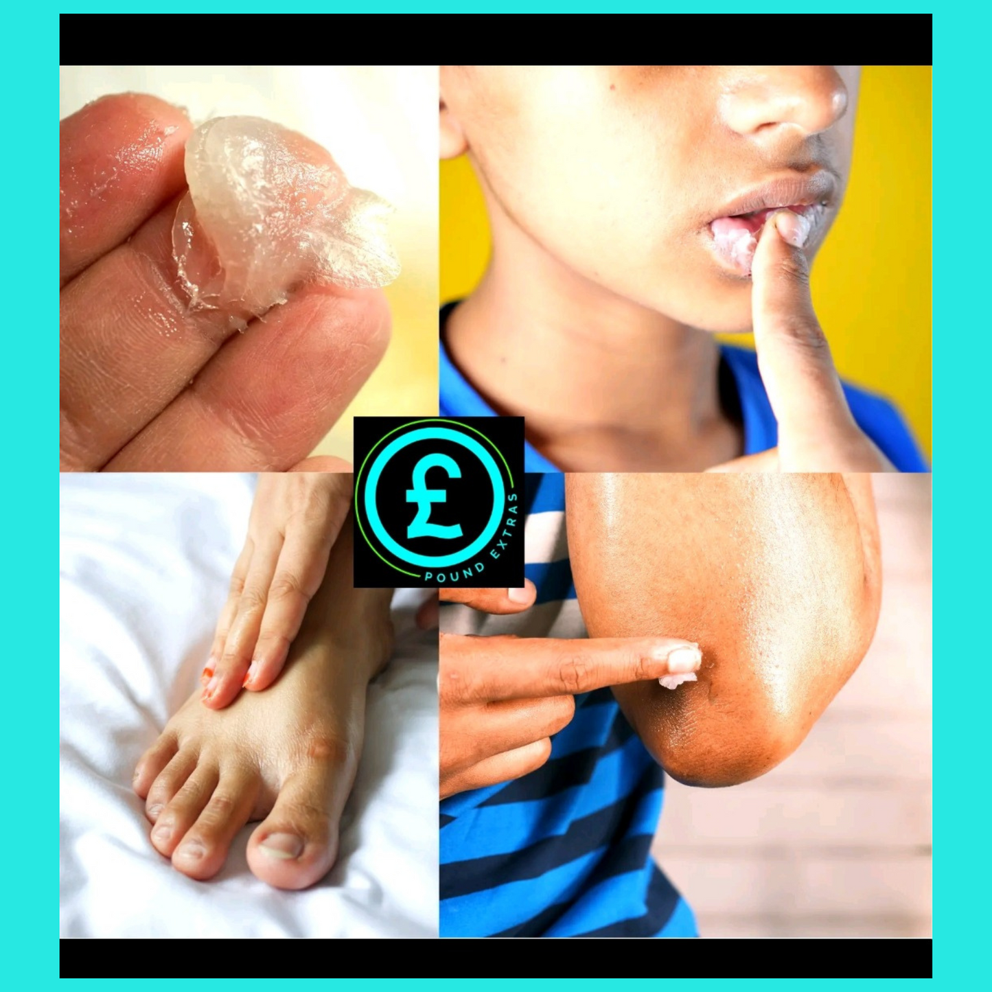 Collage of images showing skin conditions with a brand logo in the center.